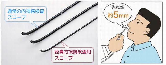 苦痛の少ない理由